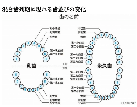 小学生のマウスピース型カスタムメイド矯正装置 インビザラインファースト とは 矯正治療について知る 名駅ma矯正歯科 マウスピース型装置インビザライン矯正専門歯科