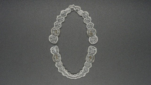 模型とマウスピース