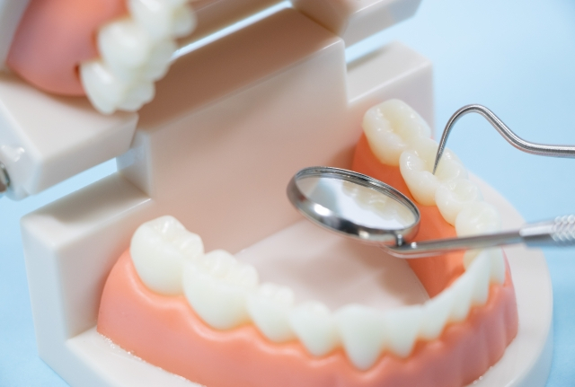 顎模型の歯をチェック